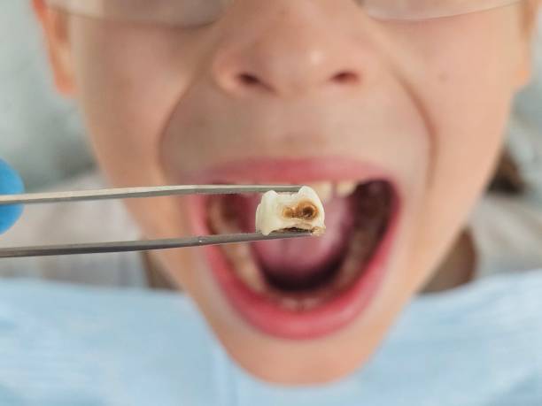 Best Tooth Pain Emergency Relief  in Temelec, CA